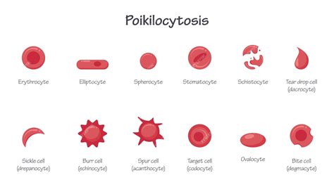 Premium Vector | Poikilocytosis morphology of erythrocytes red blood ...