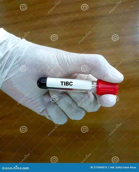 Total Iron Binding Capacity (Tibc) Test at Abby Choi blog