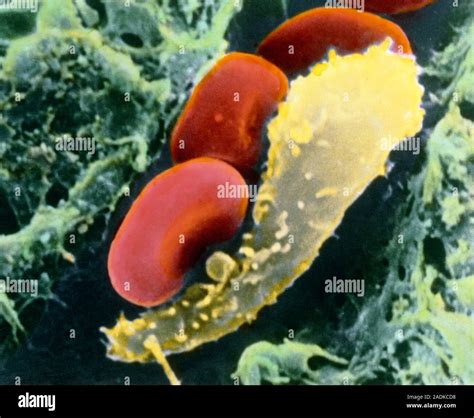 Image result for Monocyte Electron Microscope