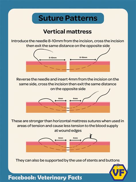 Image result for Continuous Suture Patterns