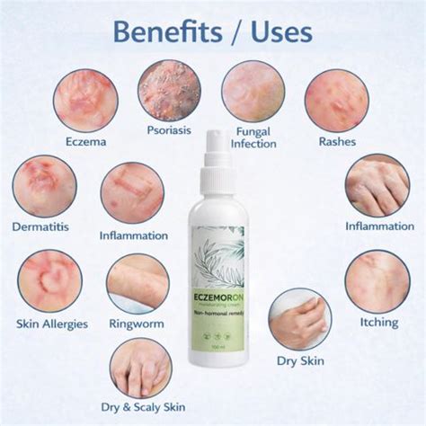 Fangruik Eczema Cream Supports Fungal Infection Cream For Men - Price ...