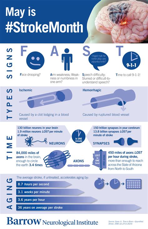 Stroke recovery timeline how long does it take to recover – Artofit