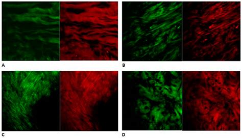Articular Disc of a Human Temporomandibular Joint: Evaluation through ...