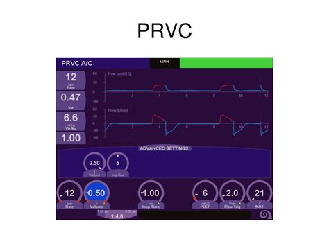 PPT - Mechanical Ventilation for Nursing PowerPoint Presentation, free download - ID:9225738
