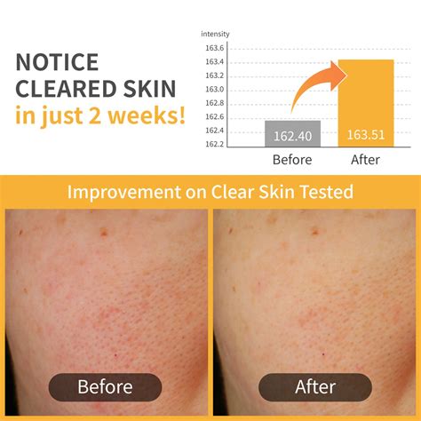 Numbuzin No.3 Radiance Glowing Jumbo Essence Pad – Limese India