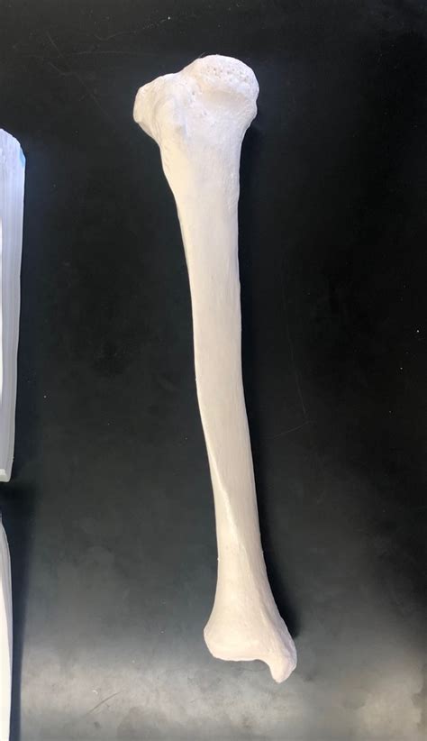 Image result for Ribstride Tibia