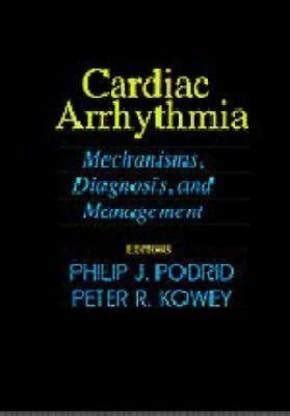Handbook of Cardiac Arrhythmia 1st Edition: Buy Handbook of Cardiac ...
