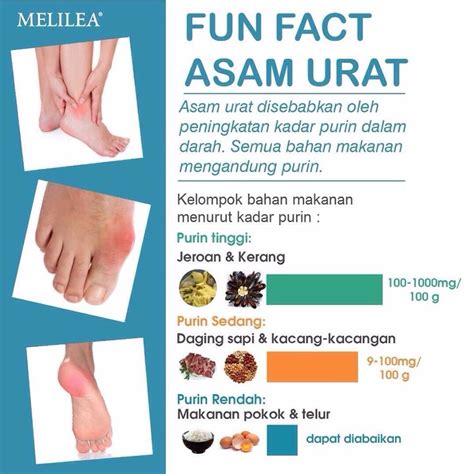 cara menghilangkan gout asam urat