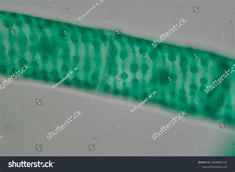 Spirogyra Under Microscope 400x Labeled