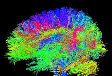 Computer Science DTI 的图像结果