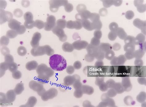 Image result for Lymphocytes Microscopic View