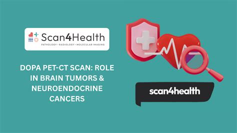 DOPA PET-CT Scan: Role in Brain Tumors & Neuroendocrine Cancers ...