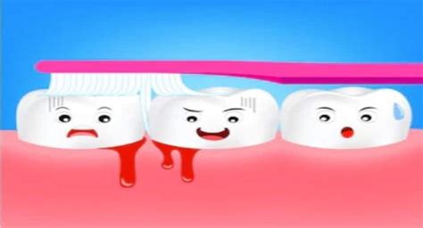 Bleeding Gum in Hindi: मसूड़ों में खून आने की समस्या का घरेलू उपचार ...