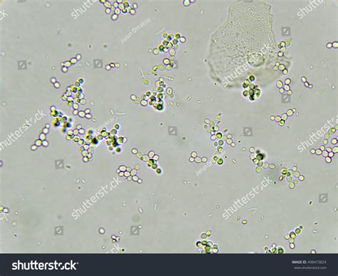 fungus in urine sediment