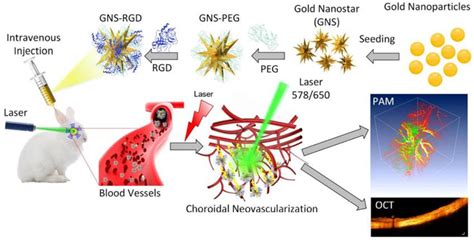 Gold Nanoparticles as Contrast Agents in Ophthalmic Imaging