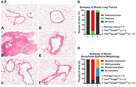 ERBB2 Regulates MED24 during Cancer Progression in Mice with Pten and ...