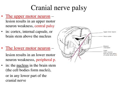 Are Cranial Nerve Nuclei Lower Motor Neurons - Infoupdate.org