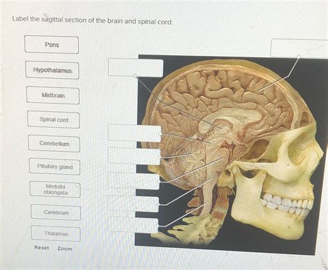 [Solved] Label the sagittal section of the brain and spinal cord. Pons ...