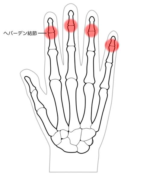 Image result for Volume Mass Problem