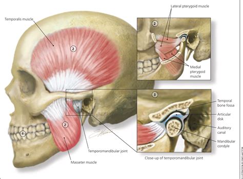 Diagnosis and Treatment of Temporomandibular Disorders | AAFP