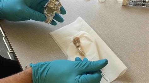 Revolutionary Bone-02 Glue Can Heal Broken Bones in Just Three Minutes ...