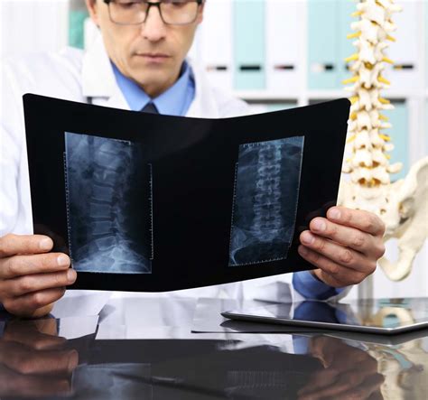 What Are Common Back Injuries From Car Accidents?