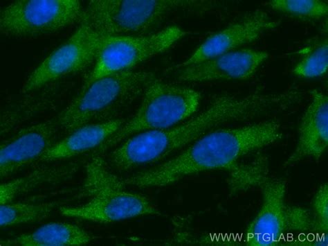 SPARC antibody (CL488-66426) | Proteintech