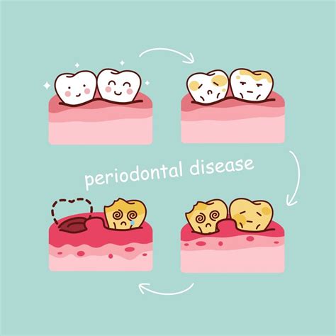 Does Periodontal Disease Go Away? - Cedar Creek Dental