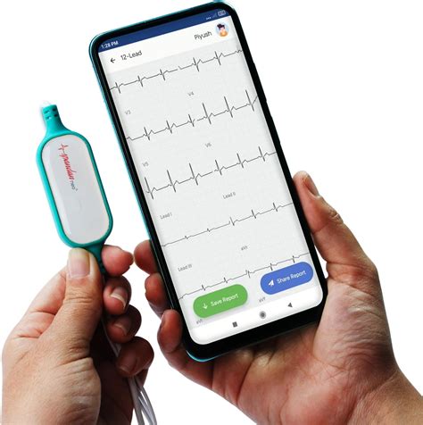 Sunfox Spandan Neo | ECG Device | Heart Rate Monitor | Detects AFib & Irregular Arrhythmias ...