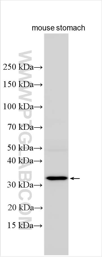 RAMP1 antibody (10327-1-AP) | Proteintech
