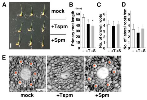Effect of Thermospermine on the Growth and Expression of Polyamine ...