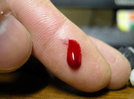 手指出血的图片真实-图库-五毛网