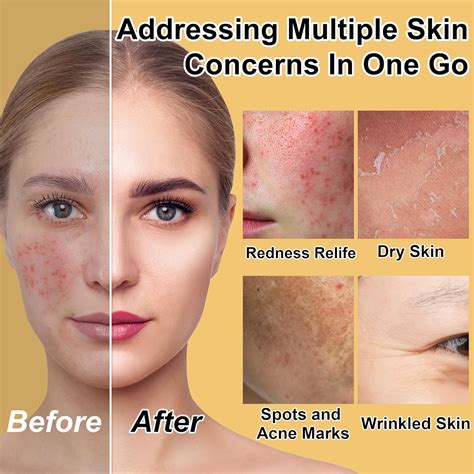 Skin Care Set for Teens Women Review – A to Z Reviews