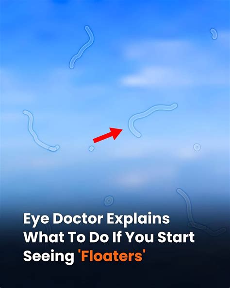 What Are Eye Floaters? Here What To Do If you Start Seeing Them, According to an Eye Doctor ...