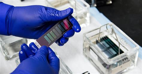 Alzheimer’s disease: Genetic research could hold some answers