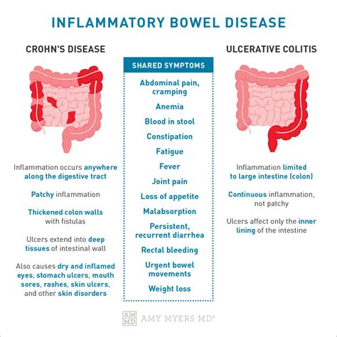 The Myers Way® Approach to Inflammatory Bowel Disease - AMMD