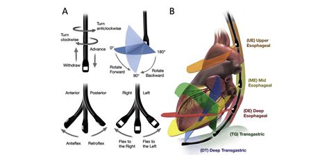 Image result for Tee Testing