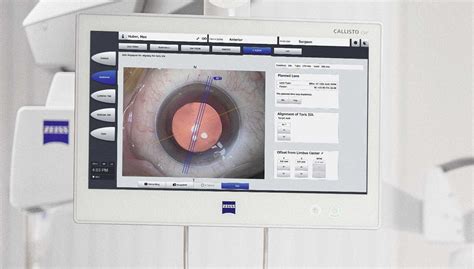 Image result for IOLMaster 500