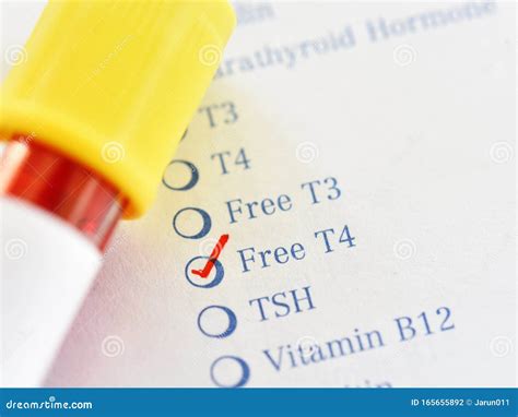 T4 Free Lab Test