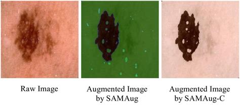 Image result for Medical Image Detection Segmentation Classification