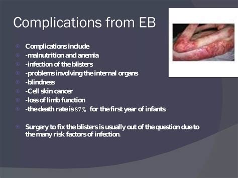 Epidermolysis Bullosa | PPT