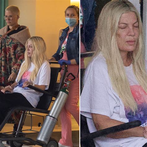 Tori Spelling Face Before And After