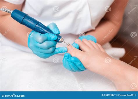 Chiropodist in Polishes the Toenails with a Mechanical Device with an Abrasive Nozzle. Close-up ...