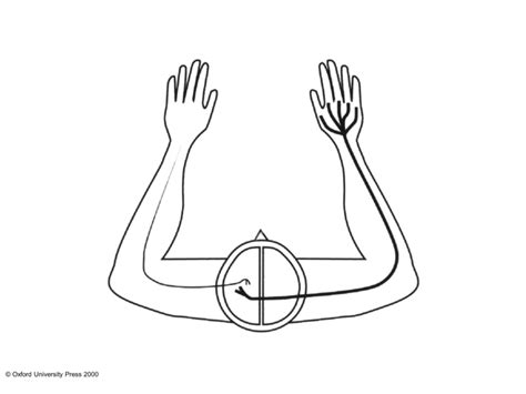 Image result for Contralateral Hemisphere