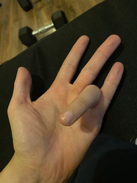 Image result for Left Hand Ring Finger