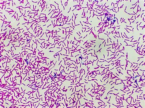 Microscopic view of gram stain showing rod shape escherichia coli or e ...