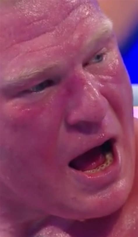 What's Wrong With Brock Lesnar Teeth - What The Hell Is Wrong With ...