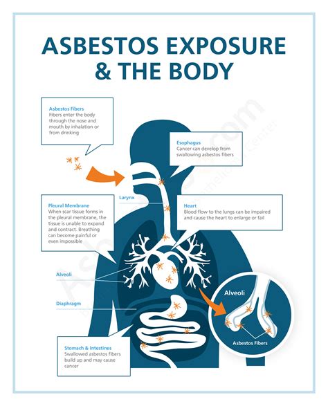 Household Exposure To Asbestos at Violet Charette blog