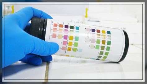 Image result for Creatinine Lab Testing