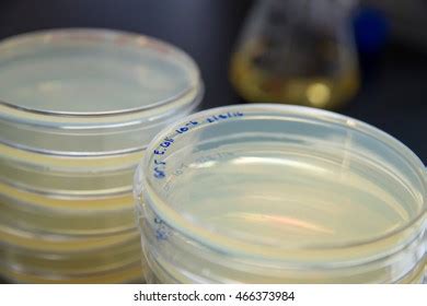 Agar Disc Diffusion Method 的图像结果